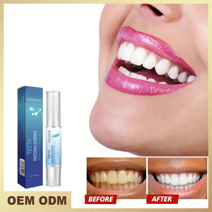 Tooth Cleaning Pen for Yellow Teeth Removal and Care